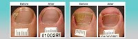 Laser Nail Clinics 699915 Image 3